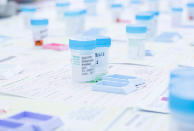 Probengefäße histologischer Proben mit Auftragsscheinen