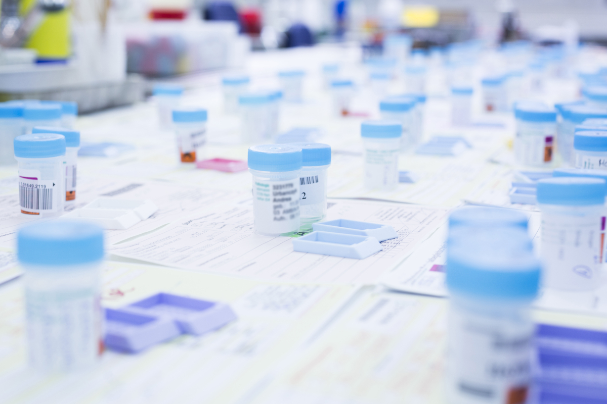 Pathologie Probenbehälter mit Auftragszetteln auf einem Tisch